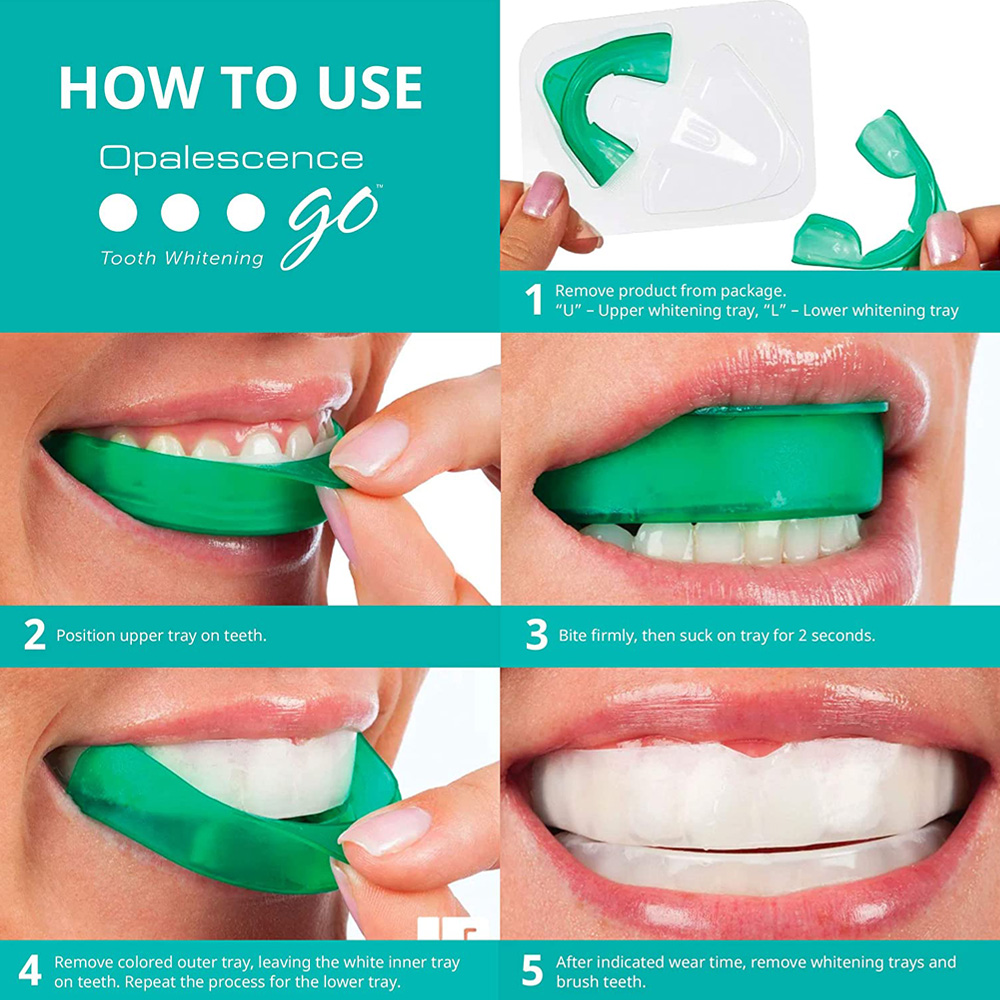 Hydrogen Peroxide For Teeth Wh - Teeth Whitening Kit review and price