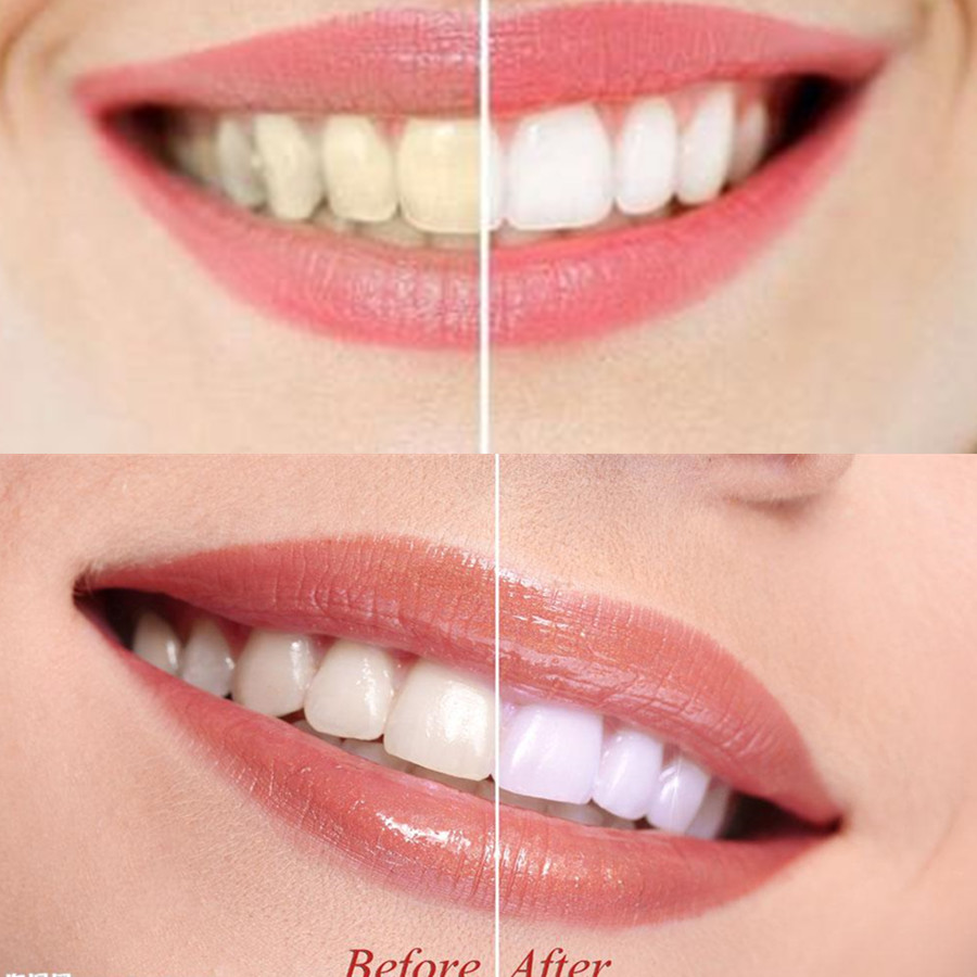 Bamboo Charcoal Teeth Tooth De - Teeth Whitening Kit review and price