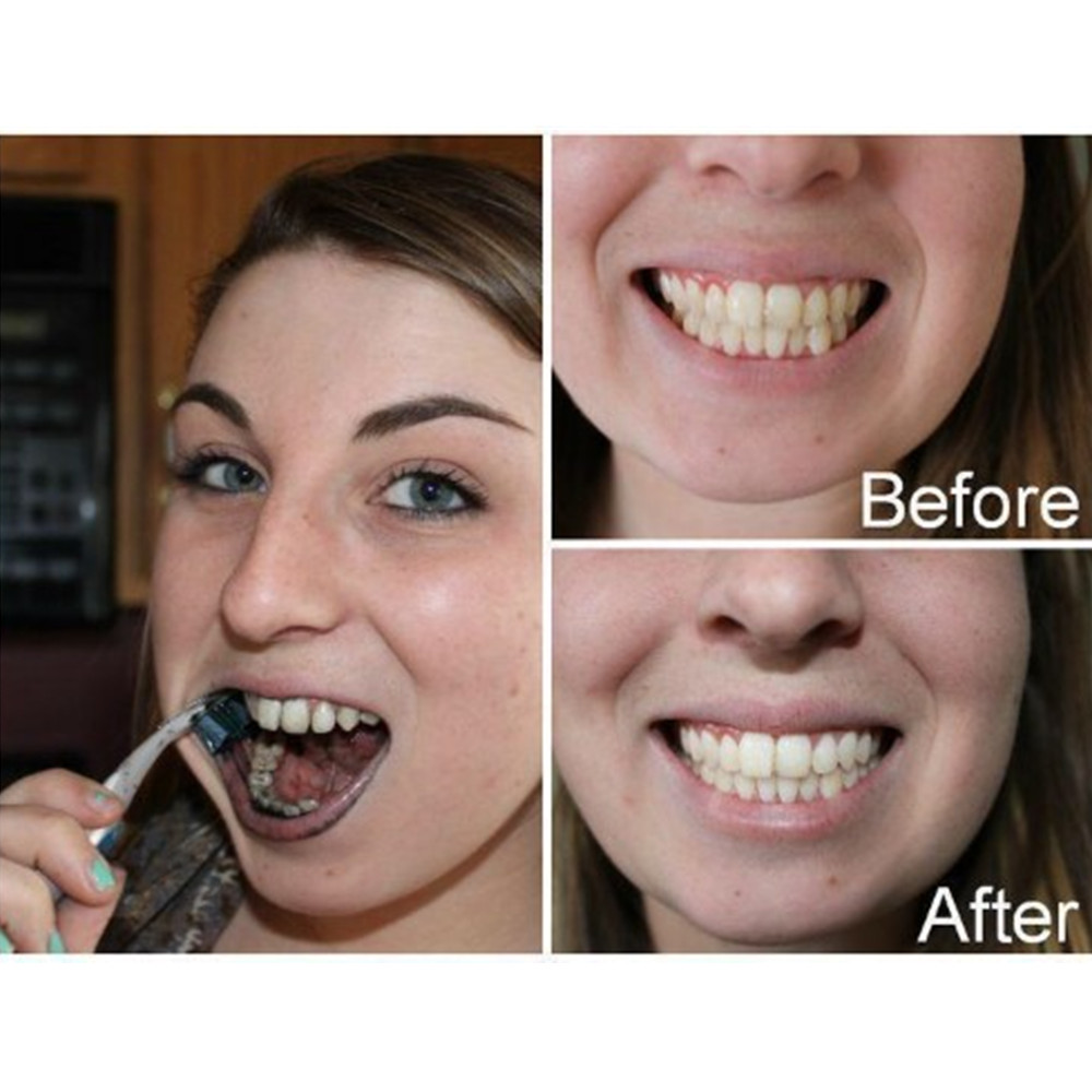 Bamboo Charcoal Teeth Tooth De - Teeth Whitening Kit review and price