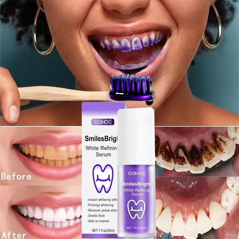 Teeth Cleansing Whitening Toot - Teeth Whitening Korea review and price