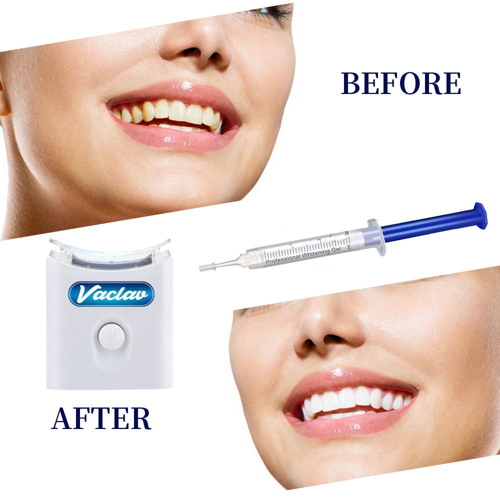 Mint Teeth Whitening Gel Syrin - Teeth Whitening Gel Syringes review and price