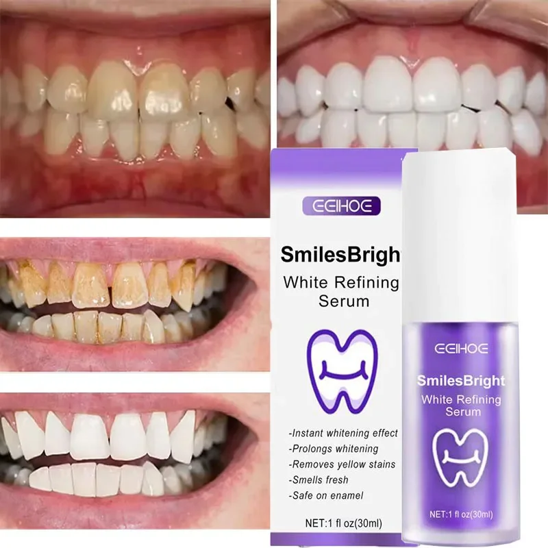 Teeth Cleansing Whitening Toot - Teeth Whitening Korea review and price