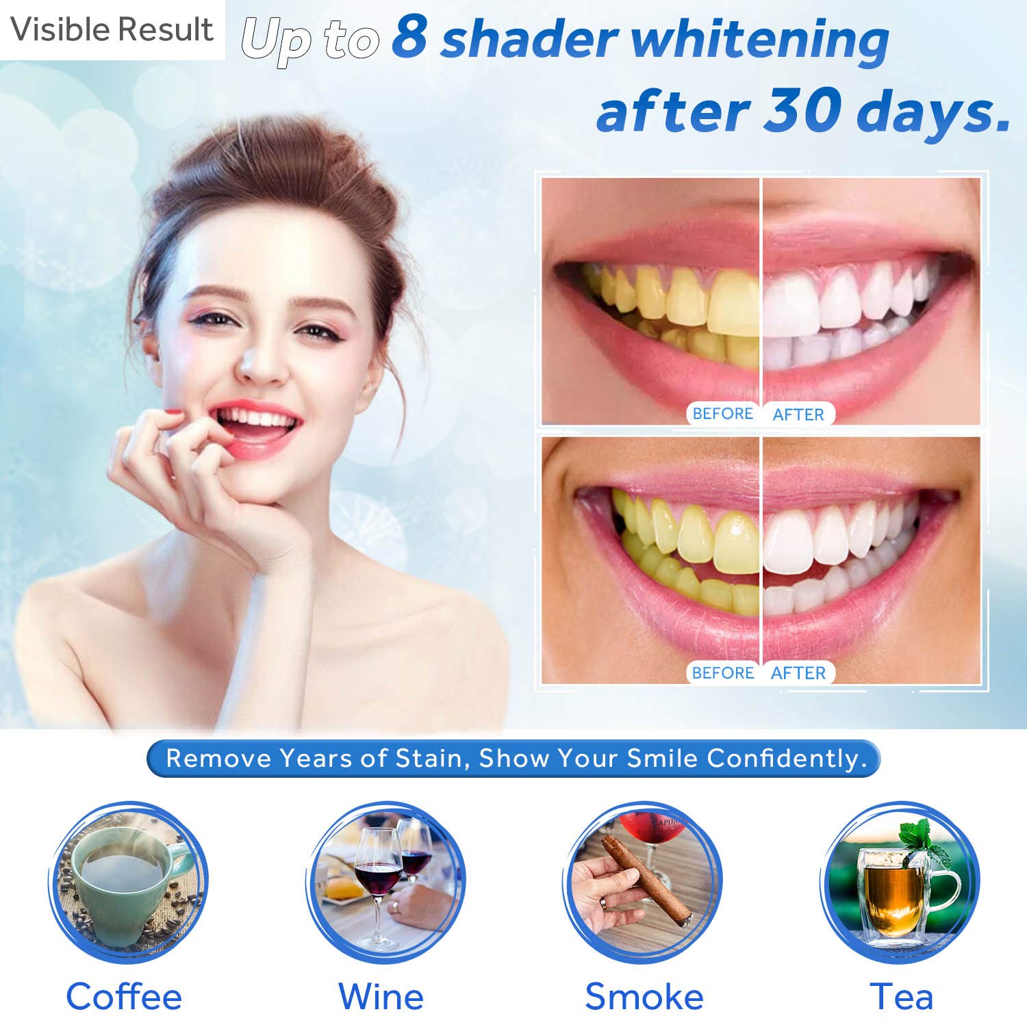 Teeth Whitening Gel Refill Syr - Teeth Whitening Gel Syringes review and price