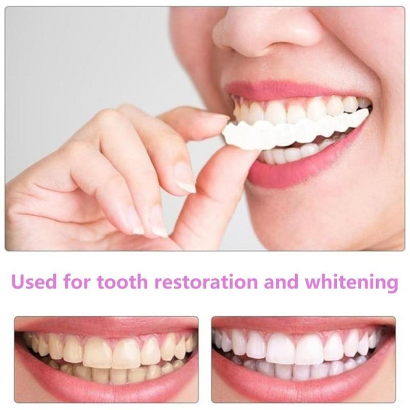 Snap On Teeth Veneers Instant  - Teeth Whitening Veneers review and price
