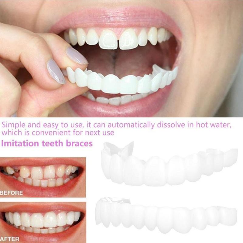 Snap On Teeth Veneers Instant  - Teeth Whitening Veneers review and price