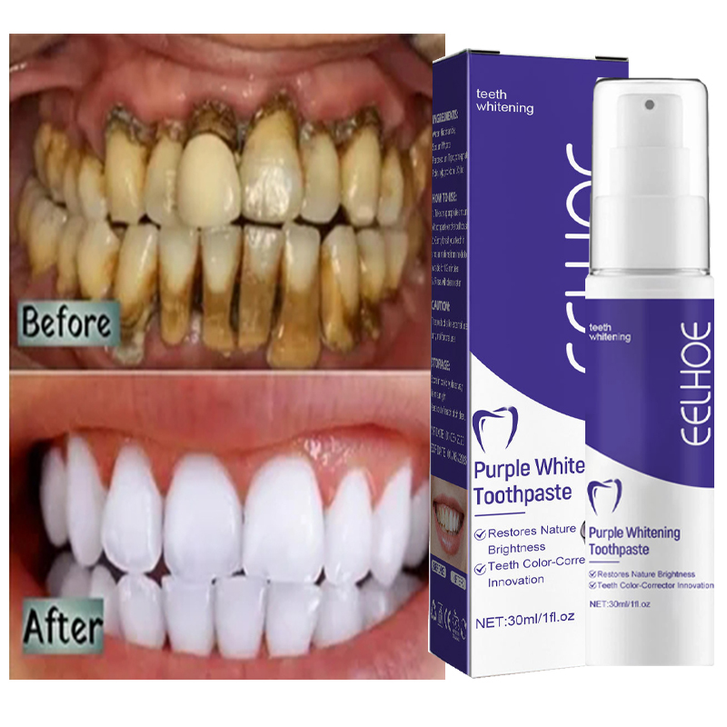 1pcs Teeth Cleansing Whitening - Teeth Whitening Korea review and price