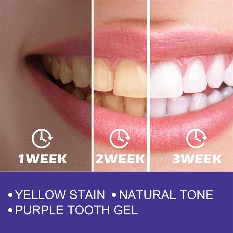 1pcs Teeth Cleansing Whitening - Teeth Whitening Korea review and price