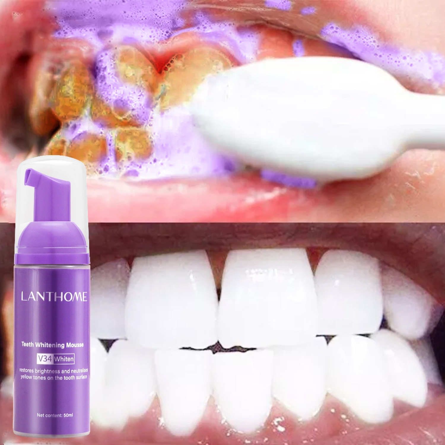 V34 Teeth Whitening Mousse Too - Teeth Whitening Xylitol review and price