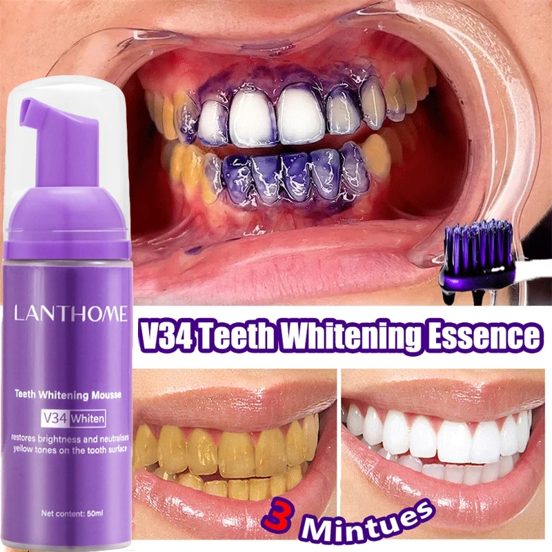 V34 Teeth Whitening Mousse Too - Teeth Whitening Xylitol review and price