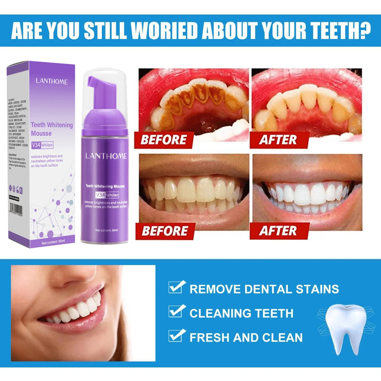 V34 Teeth Whitening Mousse Too - Teeth Whitening Xylitol review and price