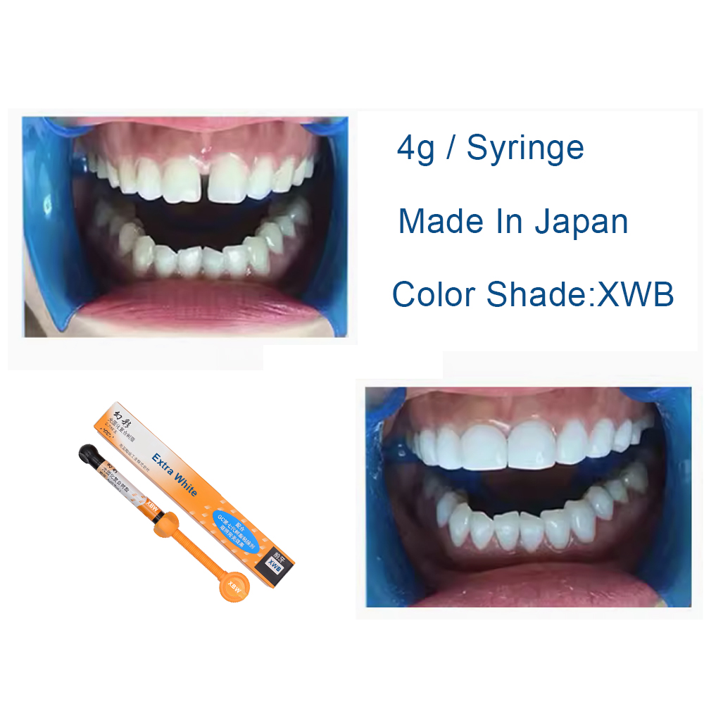 Dental Composite Resin Extra W - Teeth Whitening Veneers review and price